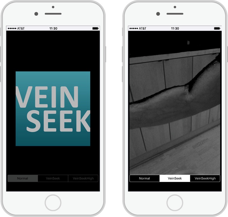 Vein Seek.jpg Vein Seek