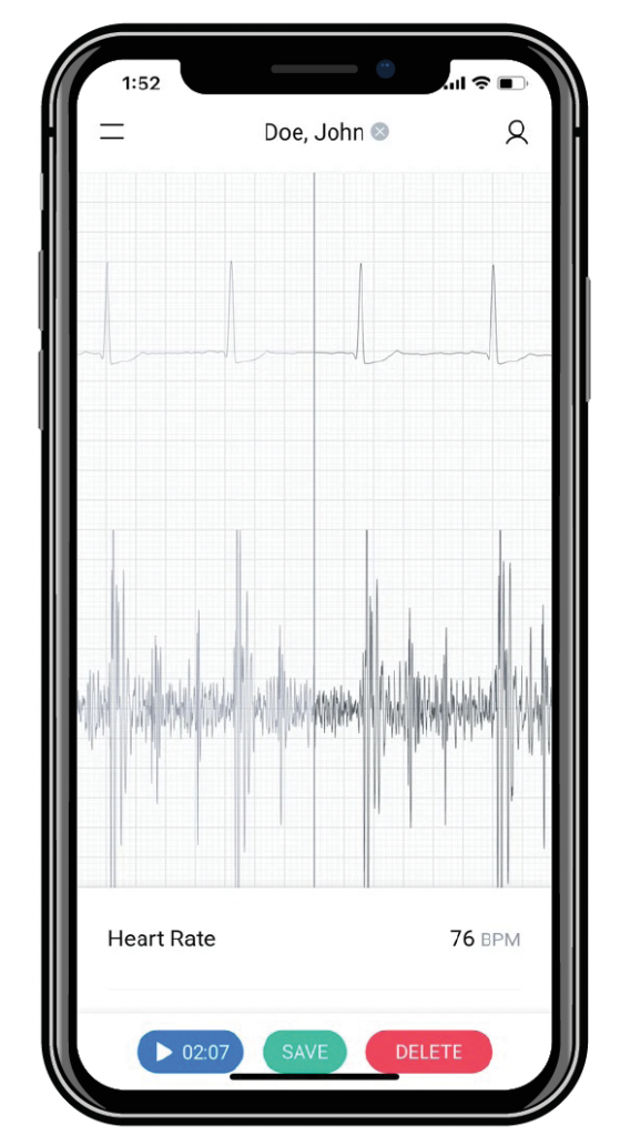 smartphone app showing heart rhythm