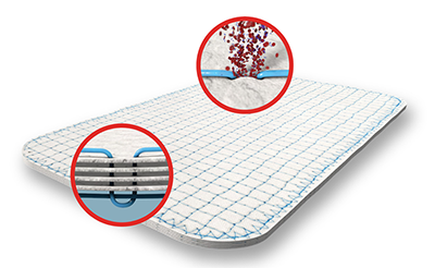TELA Bio's OviTex Reinforced Tissue Matrix
